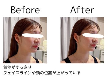 オリナ(olina)/-before & after-