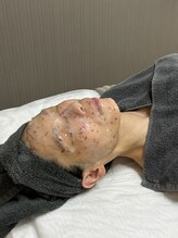 サイ(Sai)/エジプシャンローズのマスク