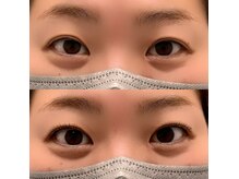 イツキ ヘアーデザイン(ITSUKI hair design)/Before→after