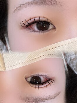 アテプラス(ate+)/アンドヘルシー