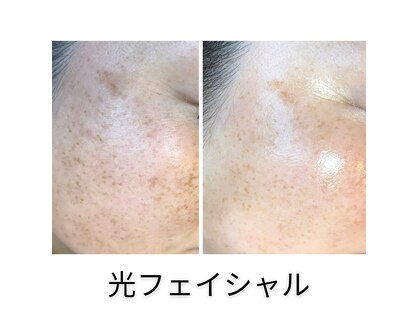 ミイル(Miiru)の写真