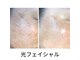 ミイル(Miiru)の写真