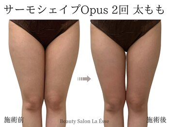 ラエッセ(La Esse)/足の隙間作るならサーモシェイプ