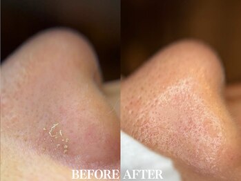 サロン ムスブ(salon MUSUBU)/山梨エステ/甲府エステ