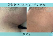 リメイククリニカルビューティー(Remake clinical beauty)/何故痒くなるの？