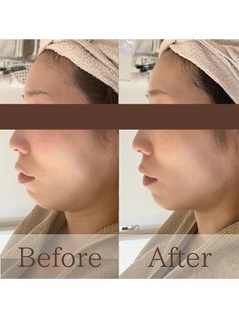 凪眠/小顔リンパフェイシャルの効果29