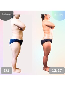 ナチュラルボディラボ 草津店/9ヶ月before→after