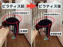 ファクト(fact)/股関節の違和感や詰まり感