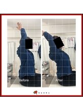 ナオル整体 錦糸町院(NAORU整体)/バンザイ可動域改善
