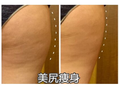リーインカーナ アーティスト(REINCARNA ARTIST)の写真