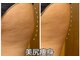 リーインカーナ アーティスト(REINCARNA ARTIST)の写真