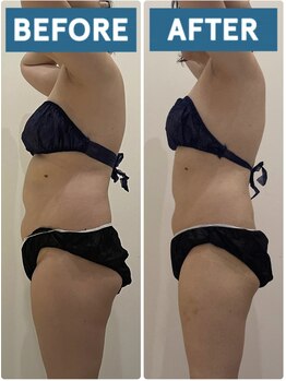 ヴォアール 東静岡店(VOIR)/サブスクVOIR会員様