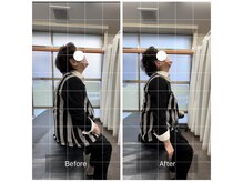 エモアメディカル整体院 麻布十番(Emoaメディカル整体院)/【70代女性】頸部痛・背部痛