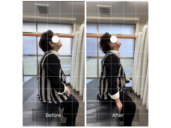 エモアメディカル整体院 麻布十番(Emoaメディカル整体院)/【70代女性】頸部痛・背部痛