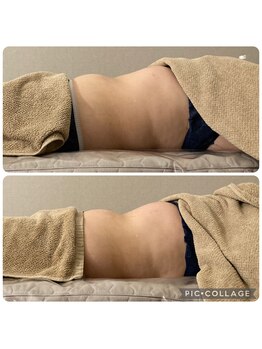 まごのて 翠/腸もみ一回