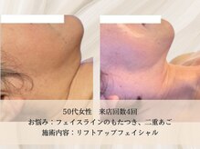 エクストリミティ 国立店(EXTREMITY)/お客様の変化