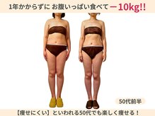 施術×食事の見直しで1年かからず-10kg！何歳からでも痩せる!!