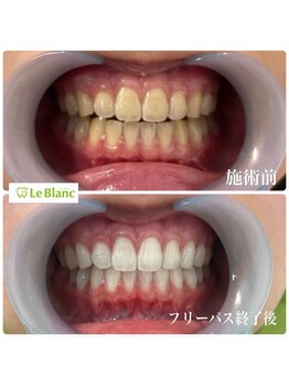ルブラン 奈良店(Le Blanc)/美意識は歯から！