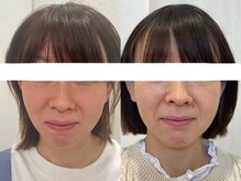 シミケア専門店 SAKURA 平塚店/各個室にクレベリン設置