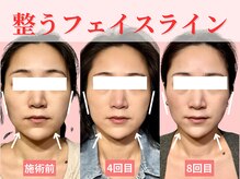 フレキシボディ(FlexiBody)の雰囲気(小顔になるの諦めてませんか?Minoruの小顔矯正整体にお任せ!)