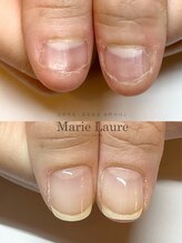 マリーロール 梅田店(Marie Laure)/自爪育成/深爪矯正/ネイルケア