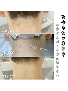 ユーサロン(U-Salon)/女性専用・完全個室【部分脱毛