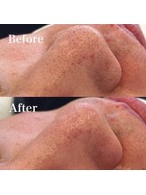 モテテ 名駅店(motete)/お客様施術例☆名駅店