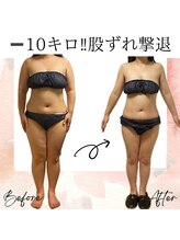 サロン ド ボーテ ラーンジュ 岐阜店(salon de beaut'e L'ange)/ハイパ-ナイフEX2ダイエット痩身