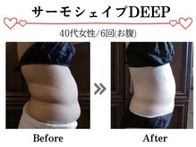 スパイア(SPIRE)/サーモシェイプDEEP★お腹