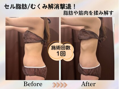カオン(kaon)の写真