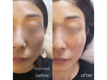 ベルミーランド 田原本/ダーマエステ&ラベンダーパック