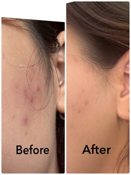 ゆるる(You*ruru)/