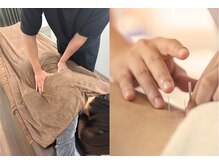 ほぐせる スター鍼灸接骨整体院 竹ノ塚 竹ノ塚東口駅前店/鍼整体！