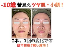 トータルビューティー雅