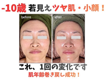トータルビューティー雅の写真