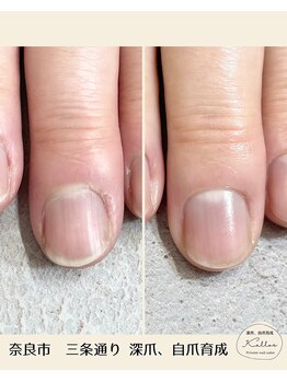 ネイルケア