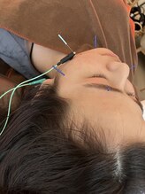 ハリファ鍼灸院 横浜関内院(HariFa鍼灸院)/美容鍼