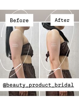 ビューティープロダクト(Beauty product)/オールハンド＋超音波/全3回