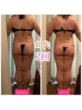 キュール(KuhL)/40代痩身ビフォーアフター☆