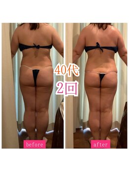 キュール(KuhL)/40代痩身ビフォーアフター☆
