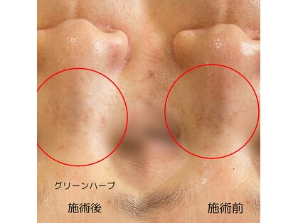 グロース(growth)の写真