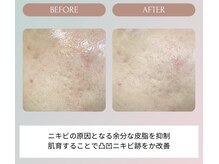 ノーブル(NOBLE)/ムートンホイップスパ大阪/野田