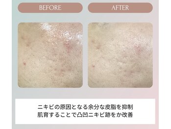 ノーブル(NOBLE)/ムートンホイップスパ大阪/野田