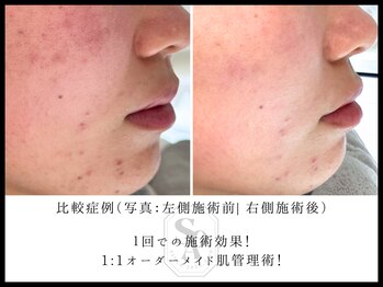 韓国肌管理室 ソア(soa)/【1:1オーダーメイド肌管理】