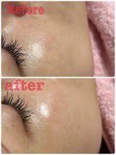 アスピリア(aspirer a')/タイムロックプログラム