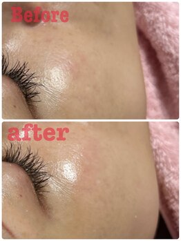 アスピリア(aspirer a')/タイムロックプログラム