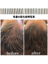 リジェ(Rege)/30代男性の方　施術＋ホームケア