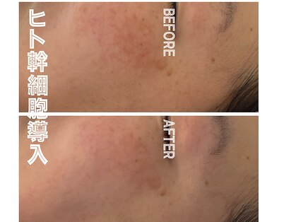 アイリーボーテ 東大阪(アイリーBEAUTE)の写真