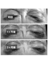 ディープブルー(Deep Blue)/ドライヘッドスパ×プラペン