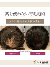 ビオ整体院 北 名古屋院/再生育毛促進術